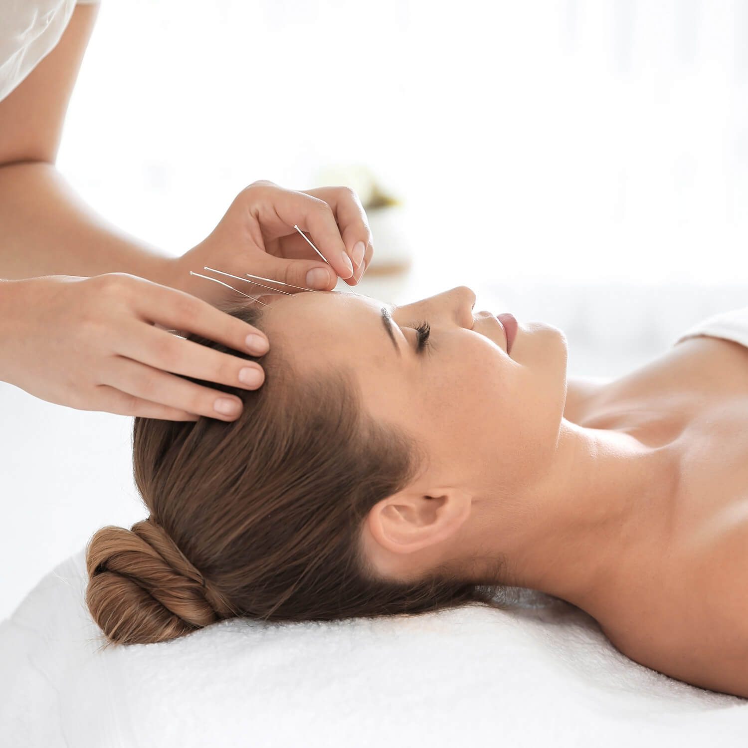 Facial Acupuncture Service