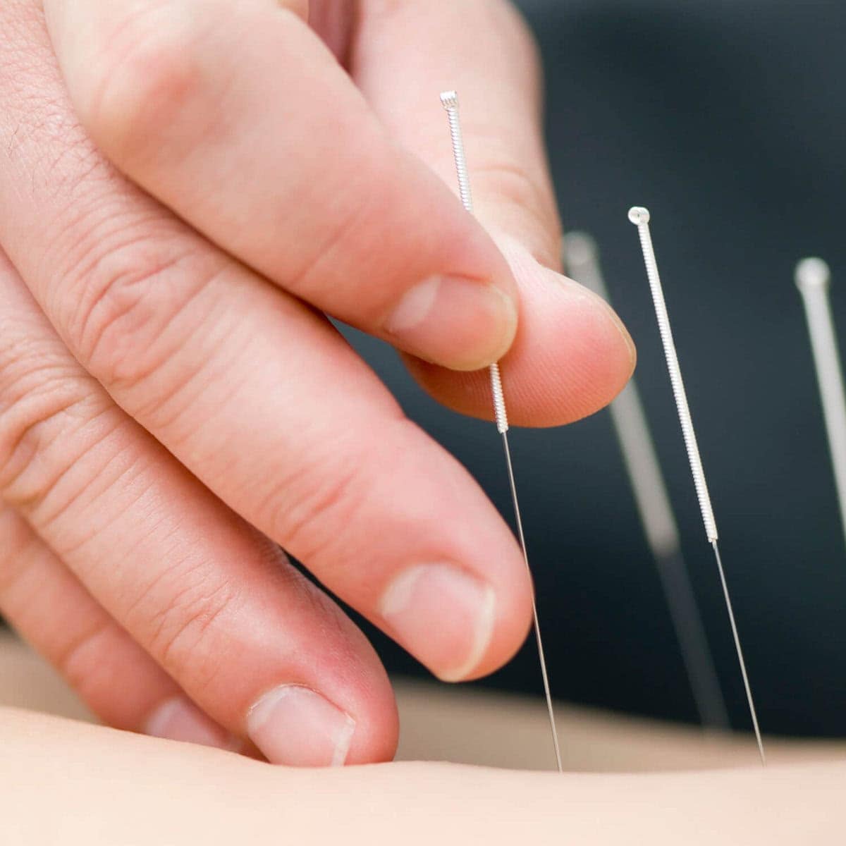 Acupuncture pricing chart for wellness services fee schedule