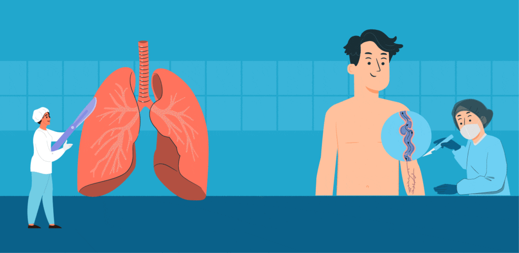 thoracic-vs-vascular-surgery