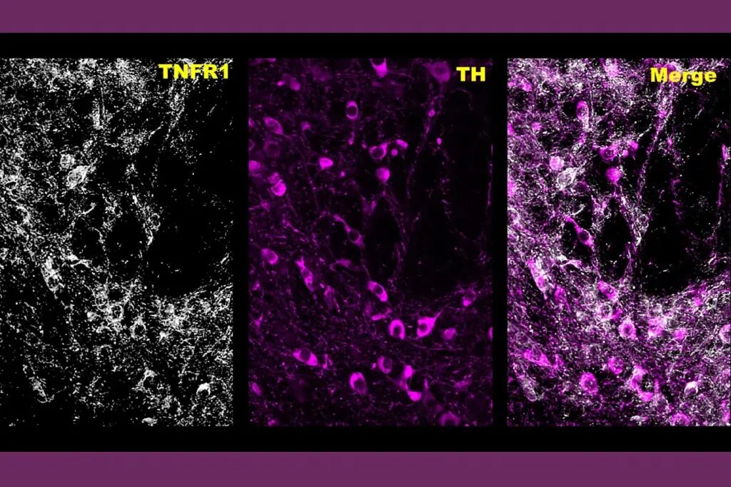 hese images show midbrain dopamine neurons expressing TNF receptor 1 (TNFR), tyrosine hydroxylase (TH) and an extensive overlap of both.