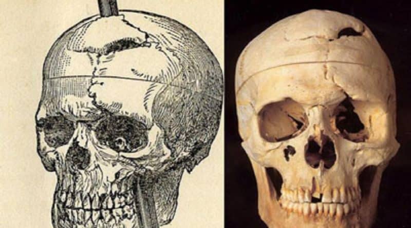 Phineas Gage