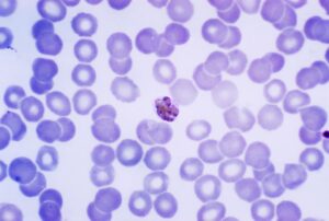 plasmodio malaria