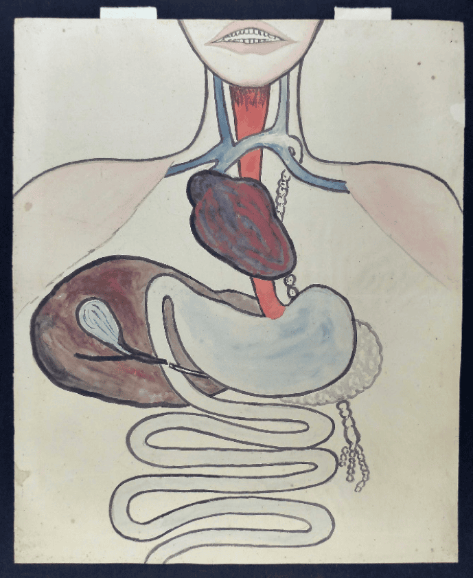 The drawing after its treatment