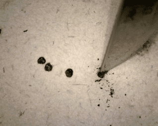 The spot damage being removed with a scalpel 