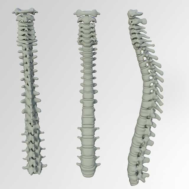 Spinal Injury Claims