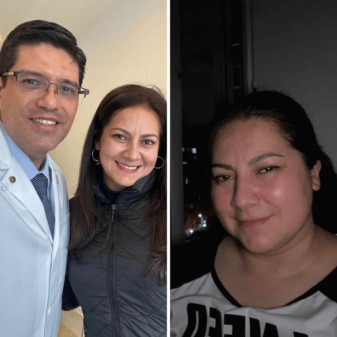 Antes y despues cirugía bariátrica