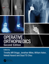 Operative Orthopaedics 2nd Edition – PDF ebook