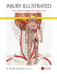 Injury Illustrated: How Medical Images Win Legal Cases 1st Edition – PDF ebook