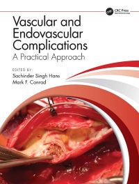 Vascular and Endovascular Complications: A Practical Approach 1st Edition – PDF ebook