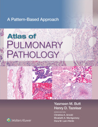 Atlas of Pulmonary Pathology: A Pattern Based Approach – PDF ebook