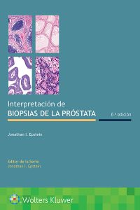 Interpretación de biopsias de la próstata 6th Edition – PDF ebook