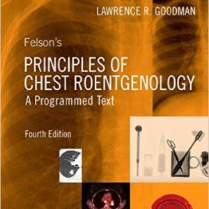 Felson's Principles of Chest Roentgenology (4th Edition) – PDF ebook