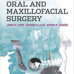 Contemporary Oral and Maxillofacial Surgery (6th Edition) – PDF ebook