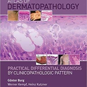 Atlas of Dermatopathology: Practical Differential Diagnosis by Clinicopathologic Pattern – PDF ebook