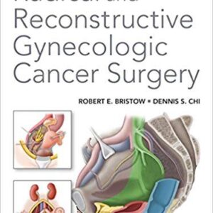 Radical and Reconstructive Gynecologic Cancer Surgery – PDF ebook