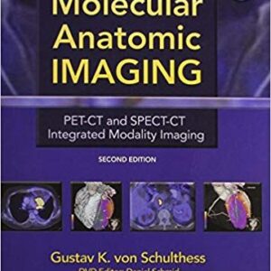 Molecular Anatomic Imaging: PET-CT and SPECT-CT Integrated Modality Imaging (2nd Edition) – PDF ebook