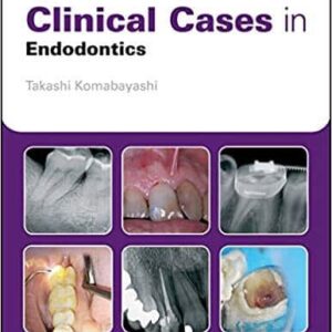 Clinical Cases in Endodontics – PDF ebook