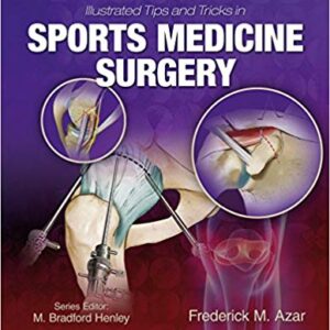 Illustrated Tips and Tricks in Sports Medicine Surgery First Edition – PDF ebook