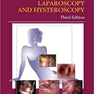 Atlas Of Operative Laparoscopy And Hysteroscopy 3Rd Edition – PDF ebook