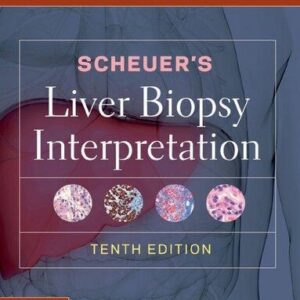Scheuers Liver Biopsy Interpretation 10Th Edition – PDF ebook