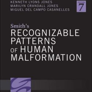 Smiths Recognizable Patterns Of Human Malformation 7Th Edition – PDF ebook