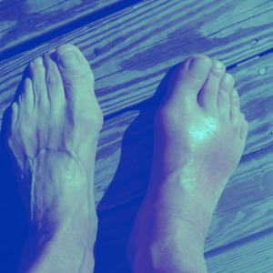 gout banner