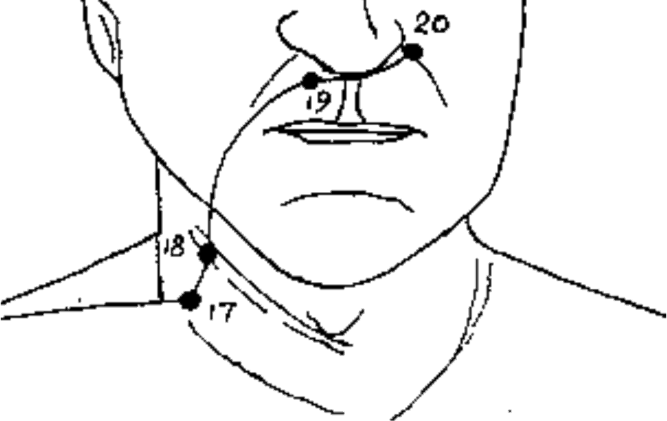 LI-20 LI-20 Painful Face Pressure Points