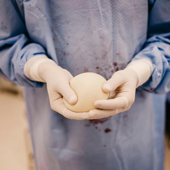 Right Choice for Breast Augmentation Surgery.