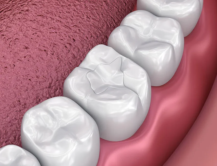 black spot on my tooth