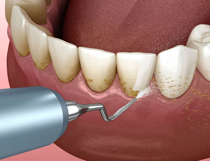 skip dental visits