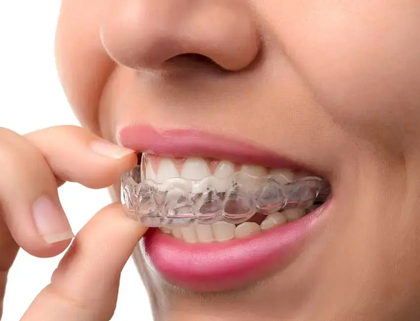 Nightguard & Sports mouthguard in Gardena | Custom-fitted