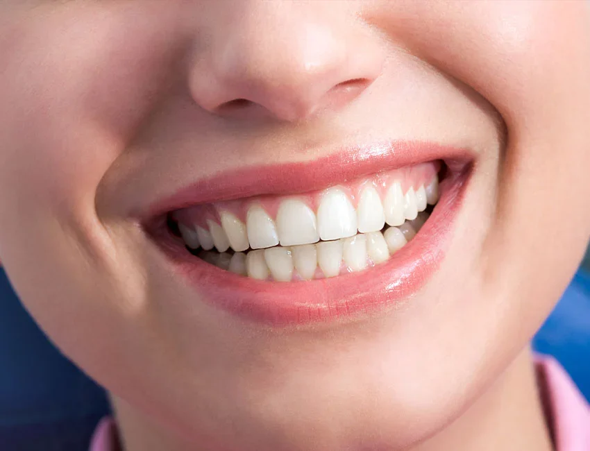 reshaping your gums
