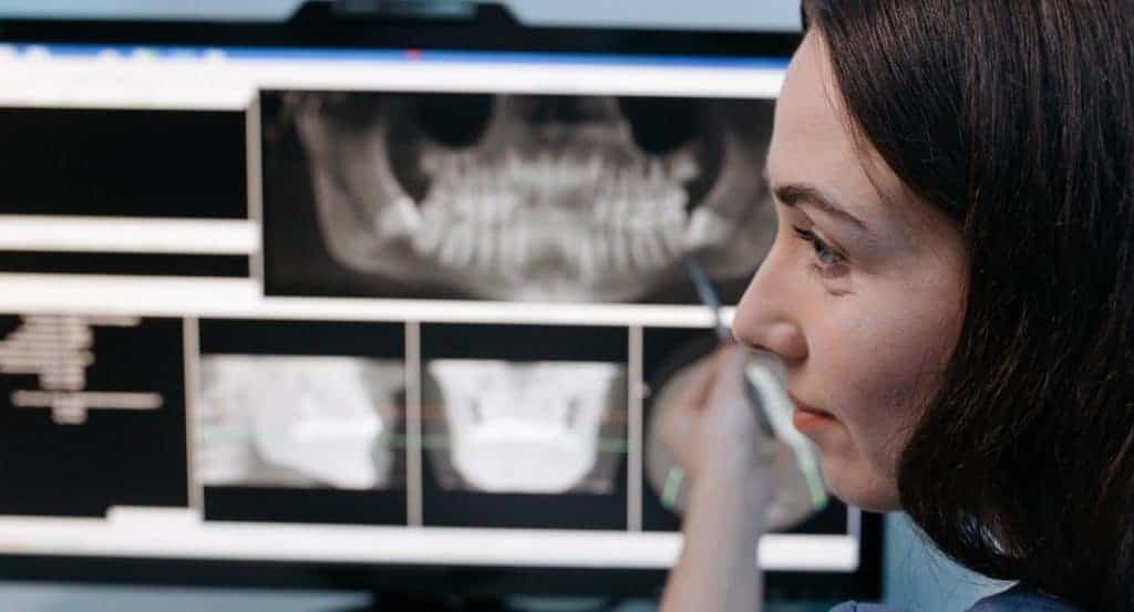 Dentist pointing at digital dental X-ray results of the jaw.