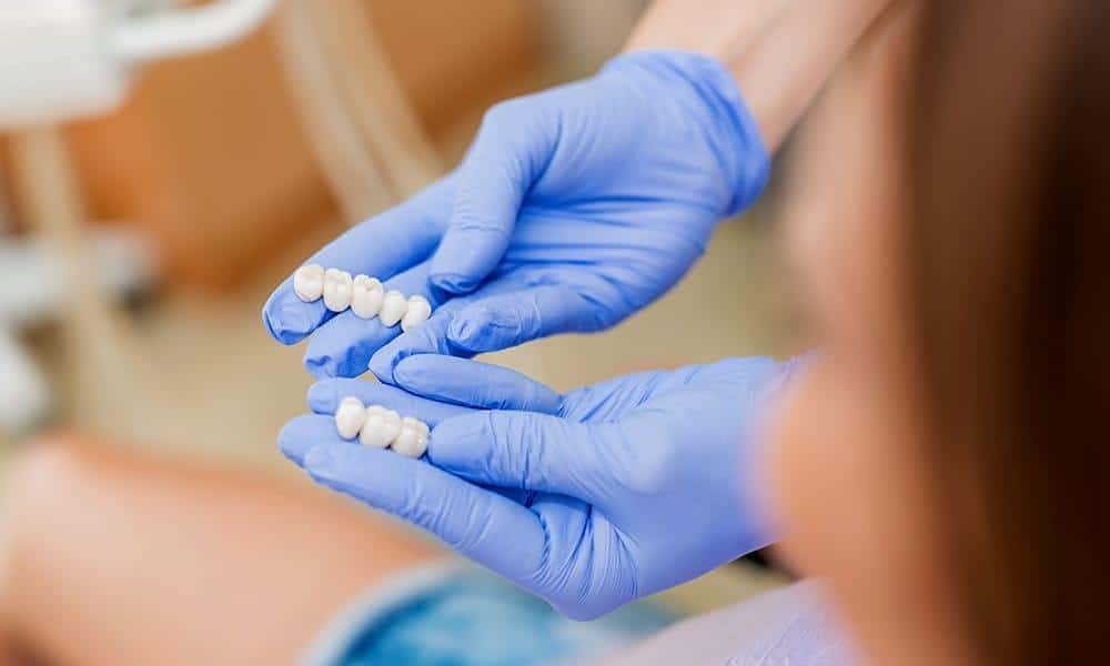 Dental professional showing teeth bridges and crowns to patient.