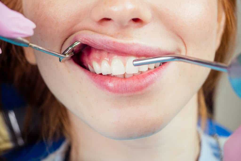 A dental procedure showing gums on a female patient.