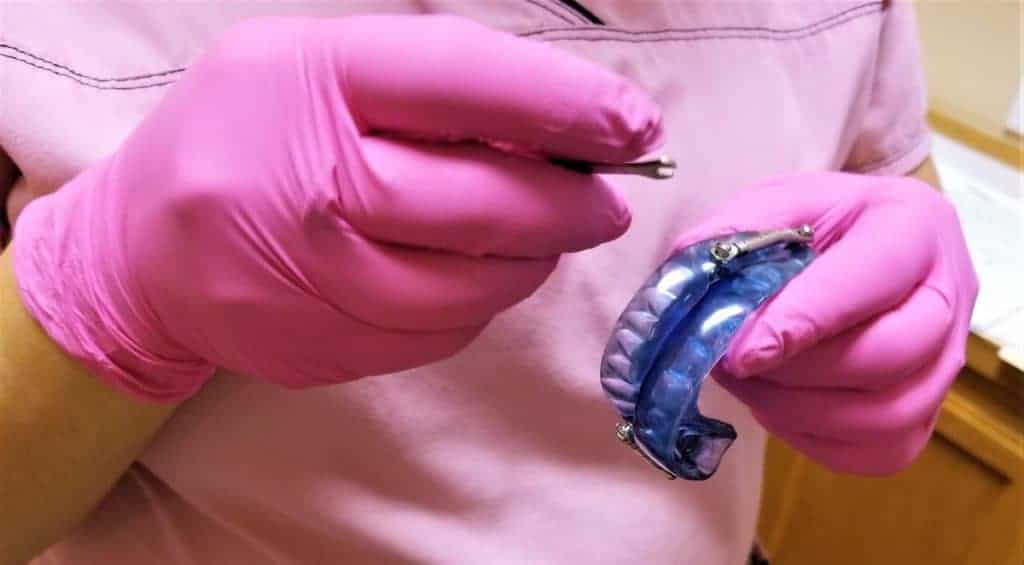 A dental professional holding a blue sleep apnea appliance.