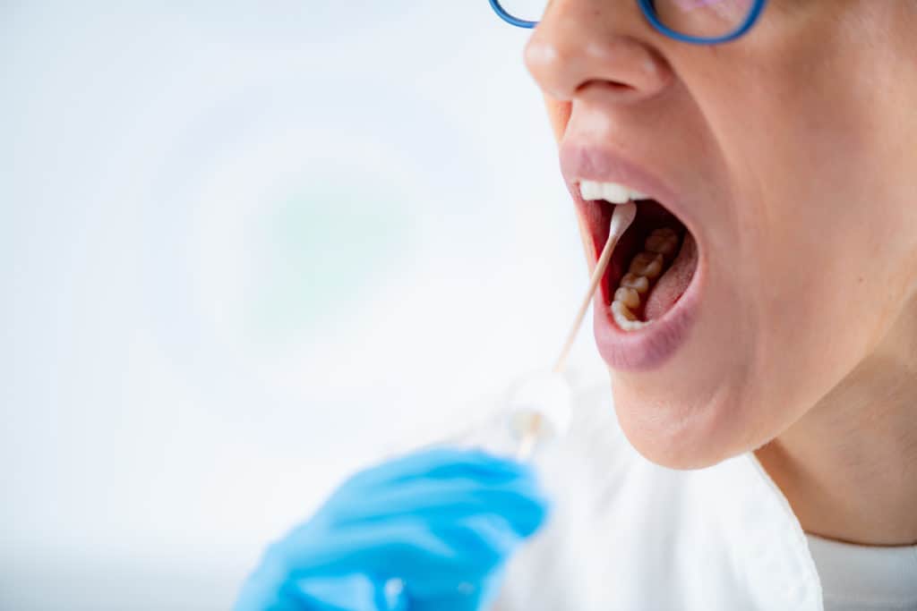 Taking a mouth swab from patient for Biofilm testing.