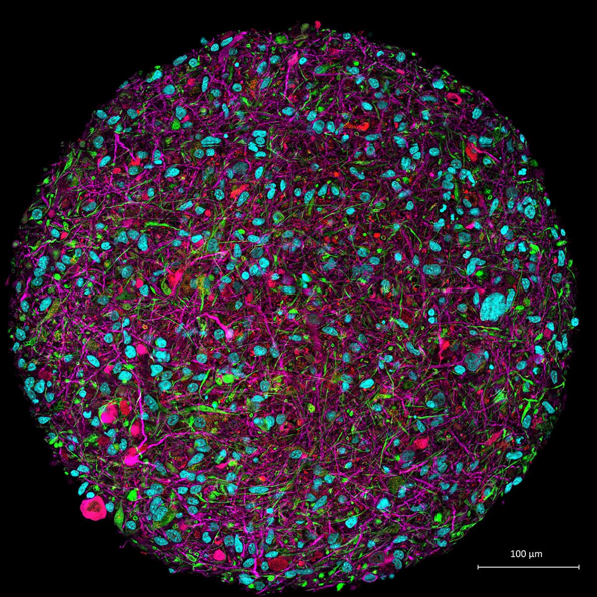 Brain organoid credit thomas hartung johns hopkins university min 1