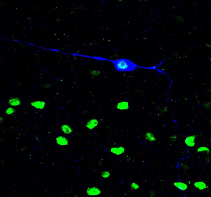 Fluorescence microscopy image of neurons coloured in green and blue