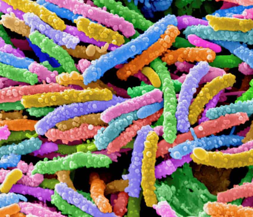 Coloured e. Coli bacteria