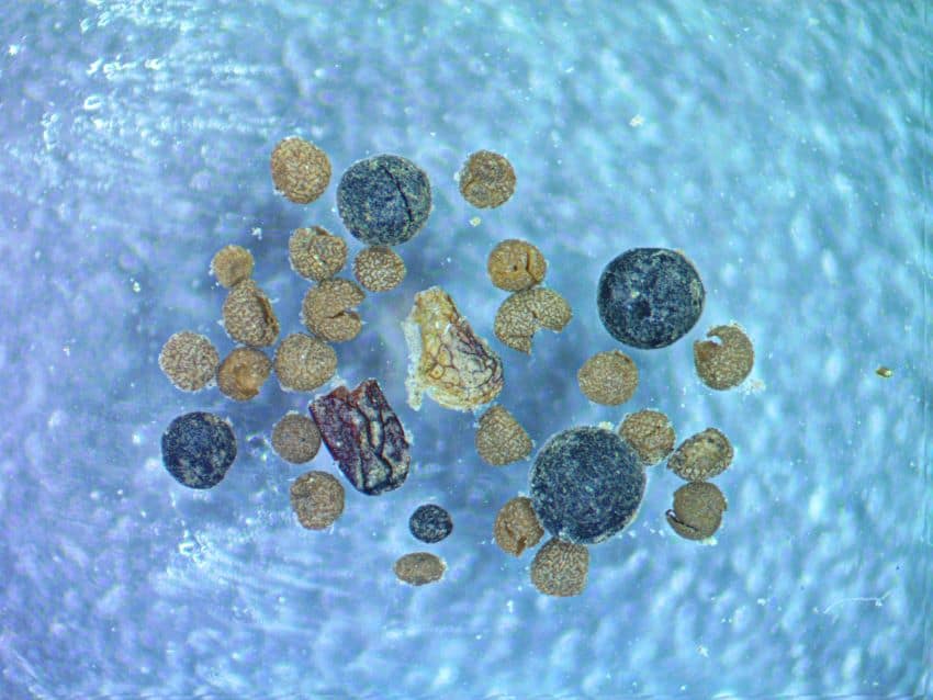 Close up of plant and fungal matter under microscope