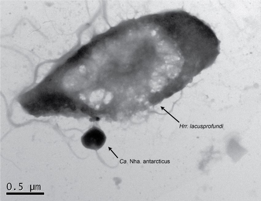 Electron microscope picture of small archaeal cell entering large archaeal cell