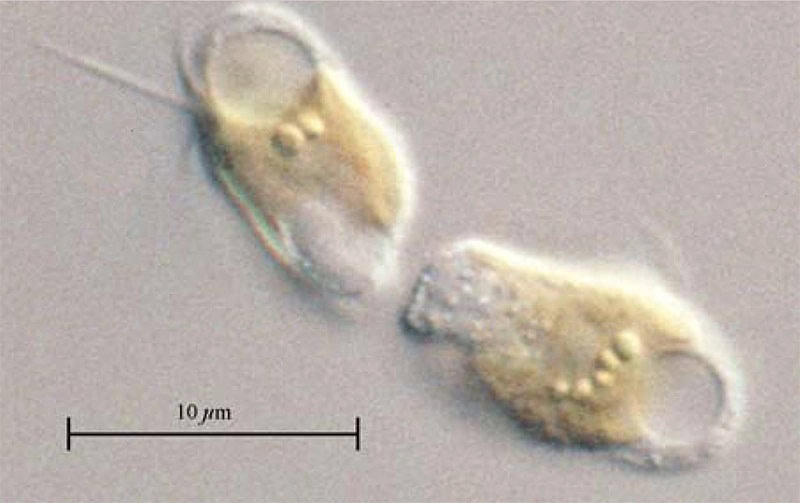 Microscope image of algae with scale bar
