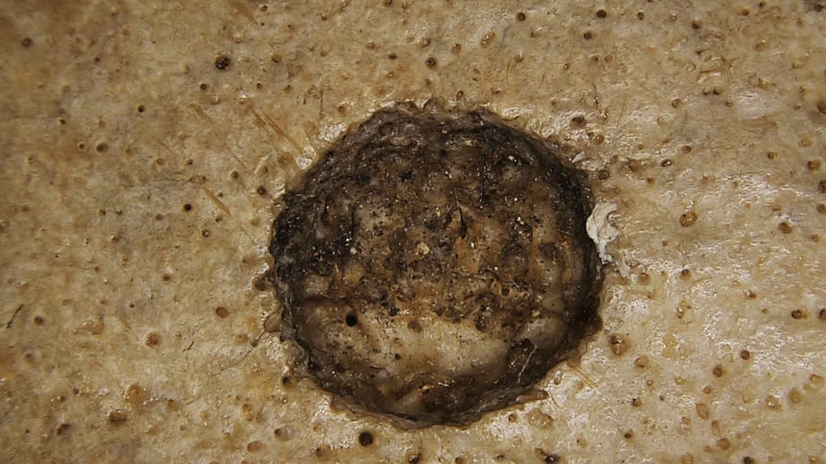 Lesion on an ancient skull with cut marks around it