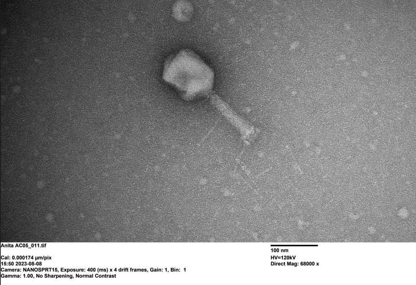 A black and white image of a bacteriophage, a virus that infects bacteria, it looks like a geometric head, with a tube body, followed by thin legs.