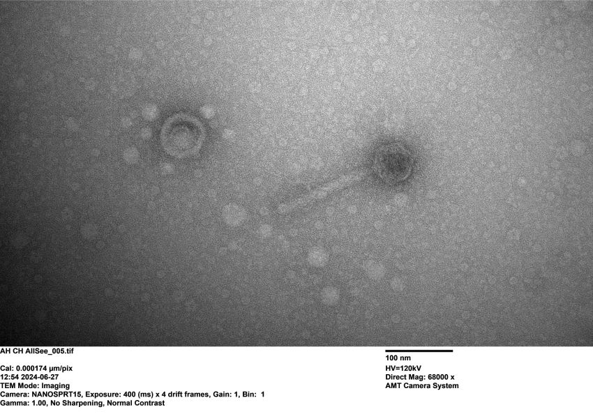 Black and white microscope image of a virus