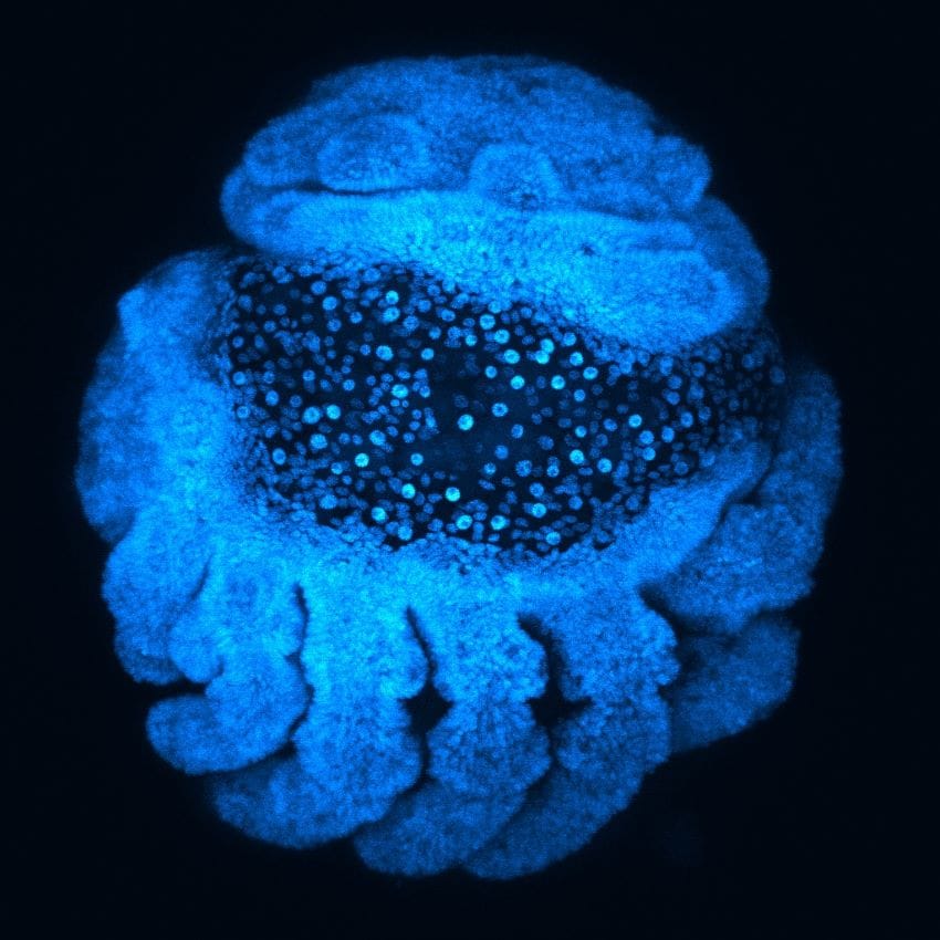 Microscope image of a spider embryo in blue.