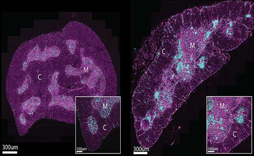 Microscope images of a slice of thymus stained purple and blue.