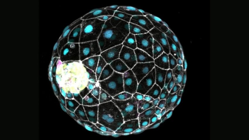 A ball of cells against a black background