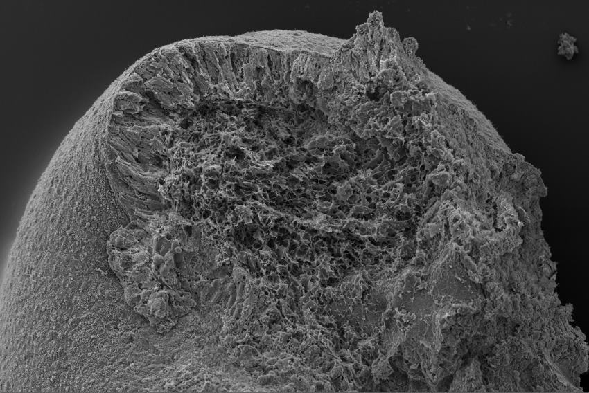 A grey-scale, very detailed image of a biological organoid